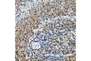 Immunohistochemistry (IHC) image for anti-Phosphoinositide-3-Kinase, Catalytic, gamma Polypeptide (PIK3CG) (AA 1-200) antibody (ABIN6145638)
