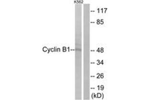Western blot analysis of extracts from K562 cells, treated with serum 10 % 15', using Cyclin B1 (Ab-126) Antibody. (Cyclin B1 Antikörper  (AA 91-140))