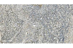 IHC analysis of LSM7 using anti-LSM7 antibody (ABIN7598937).