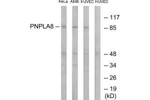 Western blot analysis of extracts from HeLa cells, A549 cells and HUVEC cells, using PNPLA8 antibody.