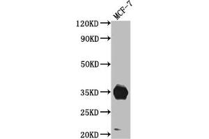 Western Blot Positive WB detected in: MCF-7 whole cell lysate All lanes: IGFBP2 antibody at 1:1000 Secondary Goat polyclonal to rabbit IgG at 1/50000 dilution Predicted band size: 35 kDa Observed band size: 35 kDa (Rekombinanter IGFBP2 Antikörper)