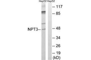 Western blot analysis of extracts from HepG2 cells, using SLC17A2 Antibody. (SLC17A2 Antikörper  (AA 213-262))