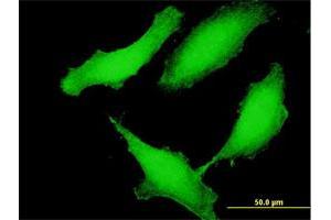 Immunofluorescence of purified MaxPab antibody to CCDC115 on HeLa cell. (CCDC115 Antikörper  (AA 1-180))