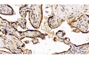 Detection of LIFR in Human Placenta Tissue using Polyclonal Antibody to Leukemia Inhibitory Factor Receptor (LIFR) (LIFR Antikörper  (AA 522-691))