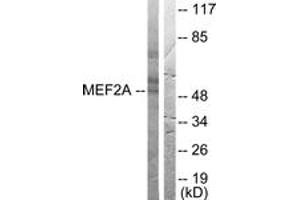 Western blot analysis of extracts from HeLa cells, treated with PMA 125ng/ml 30', using MEF2A (Ab-408) Antibody. (MEF2A Antikörper  (AA 374-423))