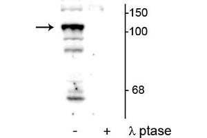 Western blot of mouse testicular lysate showing specific immunolabeling of the ~104 kDa PTPH1 phosphorylated at Ser459 in the first lane (-). (PTPN3 Antikörper  (pSer459))