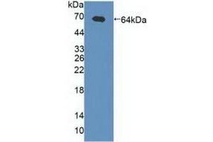 Western Blotting (WB) image for anti-gamma-aminobutyric Acid (GABA) A Receptor, alpha 2 (GABRA2) (AA 42-250) antibody (ABIN7437632)