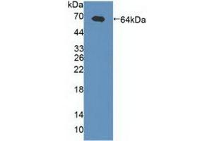 Detection of Recombinant gABRa2, Human using Polyclonal Antibody to Gamma-Aminobutyric Acid A Receptor Alpha 2 (gABRa2) (GABRA2 Antikörper  (AA 42-250))