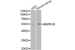 Western blot analysis of extracts of various cell lines, using BMPR1B Antibody. (BMPR1B Antikörper)