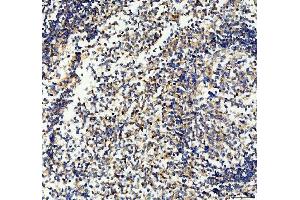IHC analysis of CD33 using anti-CD33 antibody (ABIN4886523). (CD33 Antikörper  (AA 18-259))