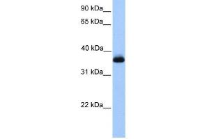 WB Suggested Anti-ERI2 Antibody Titration: 0. (ERI2 Antikörper  (Middle Region))