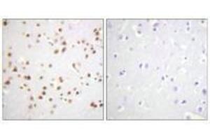 Immunohistochemistry analysis of paraffin-embedded human brain tissue using Catenin-δ1 (Ab-228) antibody. (CTNND1 Antikörper  (Tyr228))