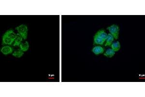 ICC/IF Image GSTZ1 antibody [N1C3] detects GSTZ1 protein at cytoplasm by immunofluorescent analysis.