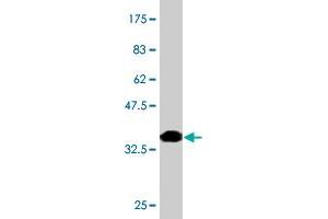 Western Blot detection against Immunogen (37.