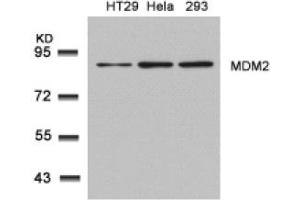 Image no. 2 for anti-Mdm2, p53 E3 Ubiquitin Protein Ligase Homolog (Mouse) (MDM2) (Ser166) antibody (ABIN319418) (MDM2 Antikörper  (Ser166))