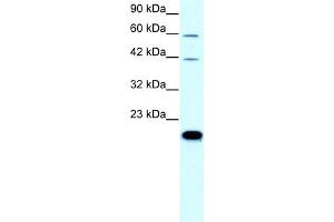 WB Suggested Anti-CLDN23 Antibody Titration:  0. (Claudin 23 Antikörper  (C-Term))