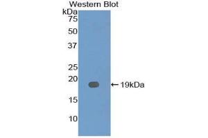 Western Blotting (WB) image for anti-Interleukin 12 Receptor, beta 2 (IL12RB2) (AA 285-441) antibody (ABIN3207280) (IL12RB2 Antikörper  (AA 285-441))