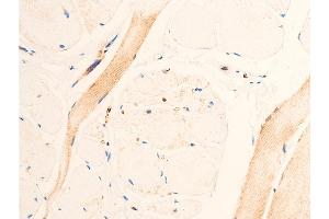 Immunohistochemistry (IHC) image for anti-Transforming Growth Factor, beta 1 (TGFB1) (C-Term) antibody (ABIN6266431)