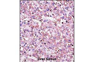 IGF1 Antibody (C-term) (ABIN658020 and ABIN2837861) immunohistochemistry analysis in formalin fixed and paraffin embedded human liver tissue followed by peroxidase conjugation of the secondary antibody and DAB staining. (IGF1 Antikörper  (C-Term))