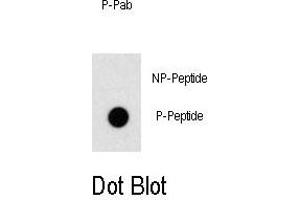 Dot blot analysis of anti-Phospho-OSR1-p Antibody Antibody (ABIN389959 and ABIN2839760) on nitrocellulose membrane. (OSR1 Antikörper  (pThr310))