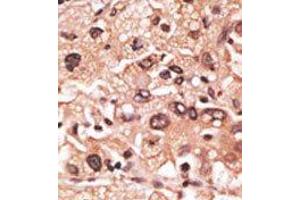 Image no. 2 for anti-Melanoma Antigen Family F, 1 (MAGEF1) (C-Term) antibody (ABIN358660) (MAGEF1 Antikörper  (C-Term))