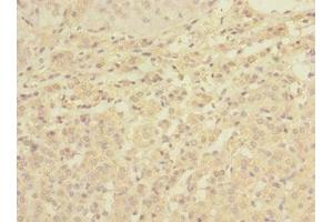 Immunohistochemistry of paraffin-embedded human adrenal gland tissue using ABIN7174780 at dilution of 1:100 (C1ORF127 Antikörper  (AA 401-648))
