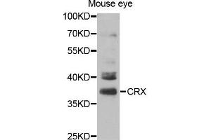 Western blot analysis of extracts of Mouse eye cell line, using CRX antibody. (CRX Antikörper)