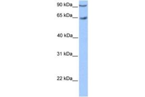 Western Blotting (WB) image for anti-Zinc Finger Protein 449 (ZNF449) antibody (ABIN2460405) (ZNF449 Antikörper)