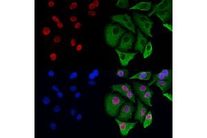 ABIN6263417 and ABIN6272965 staining Hela cells by IF/ICC.