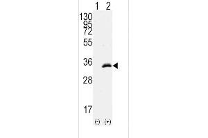 Western blot analysis of CDK1(arrow) using rabbit polyclonal CDK1 Antibody (T14) (ABIN391744 and ABIN2841621).