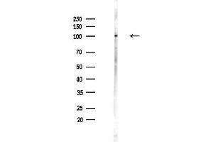 Western blot analysis of lysates from PC12 cells(UV,30 min treatment), using SAFB Antibody at 1/1000 dilution.