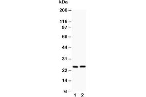 Western blot testing of Claudin 2 antibody and Lane 1:  rat kidney;  2: rat liver (Claudin 2 Antikörper  (AA 38-230))