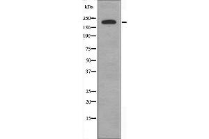 Western blot analysis of extracts from COLO cells, using BCOR antibody. (BCOR Antikörper  (Internal Region))