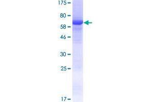 Chromosome 15 Open Reading Frame 58 (C15orf58) (AA 1-385) protein (GST tag)