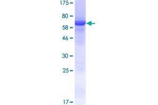 Chromosome 15 Open Reading Frame 58 (C15orf58) (AA 1-385) protein (GST tag)