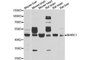 Western blot analysis of extracts of various cell lines, using NHLRC1 antibody. (NHLRC1 Antikörper)