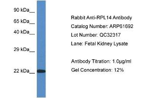 Western Blotting (WB) image for anti-Ribosomal Protein L14 (RPL14) (C-Term) antibody (ABIN2788870)