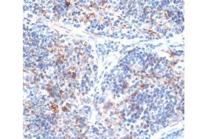 Immunohistochemistry of paraffin-embedded Rat spleen using SLAMF7 Polyclonal Antibody at dilution of 1:100 (40x lens). (SLAMF7 Antikörper)