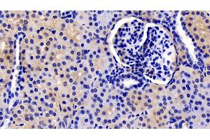 Detection of TSLP in Human Kidney Tissue using Monoclonal Antibody to Thymic Stromal Lymphopoietin (TSLP)