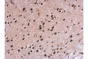 IHC-P Image NPAS1 antibody detects NPAS1 protein at nucleus on rat fore brain by immunohistochemical analysis.