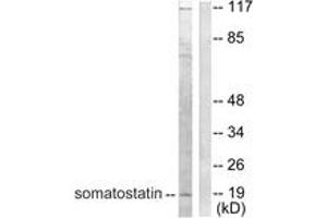 Western blot analysis of extracts from A549 cells, using Somatostatin Antibody. (Somatostatin Antikörper  (AA 10-59))