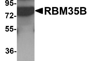 Western blot analysis of RBM35B in human lung tissue lysate with RBM35B antibody at 1 µg/mL. (ESRP2 Antikörper  (C-Term))