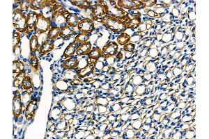 ABIN6260861 and ABIN6266513 at 1/100 staining Mouse kidney tissue by IHC-P.