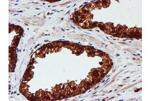 Image no. 9 for anti-Chromosome 1 Open Reading Frame 50 (C1ORF50) antibody (ABIN1497033)
