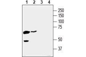 Western blot analysis of human K562 chronic myelogenous leukemia cell line lysate (lanes 1 and 3) and human MDA-MB-231 breast adenocarcinoma cell line lysate (lanes 2 and 4): - 1,2. (SLC16A3 Antikörper  (C-Term, Intracellular))