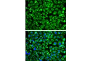 Immunofluorescence analysis of A-549 cells using S antibody . (SAT2 Antikörper  (AA 1-170))
