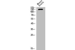 Western Blot analysis of mouse brain cells using CD101 Polyclonal Antibody (CD11 Antikörper  (Internal Region))