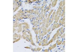 Immunohistochemistry of paraffin-embedded mouse heart using CRHBP antibody (ABIN5973945) at dilution of 1/100 (40x lens). (CRHBP Antikörper)