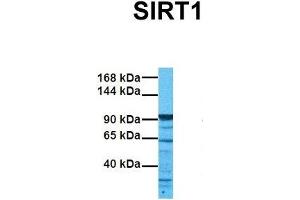 Host:  Rabbit  Target Name:  SIRT1  Sample Tissue:  Human 786-0  Antibody Dilution:  1. (SIRT1 Antikörper  (N-Term))