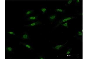 Immunofluorescence of monoclonal antibody to ATF2 on HeLa cell. (ATF2 Antikörper  (AA 241-340))